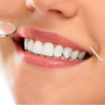 Laser clinic – Professional teeth whitening for a radiant smile.