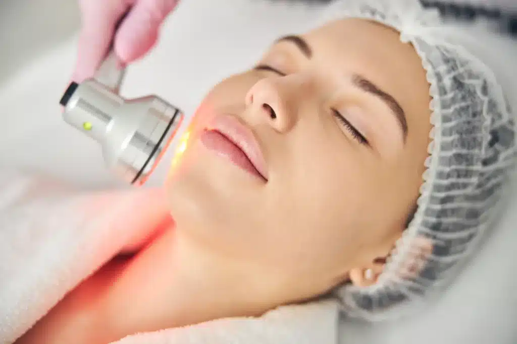 laser treatments